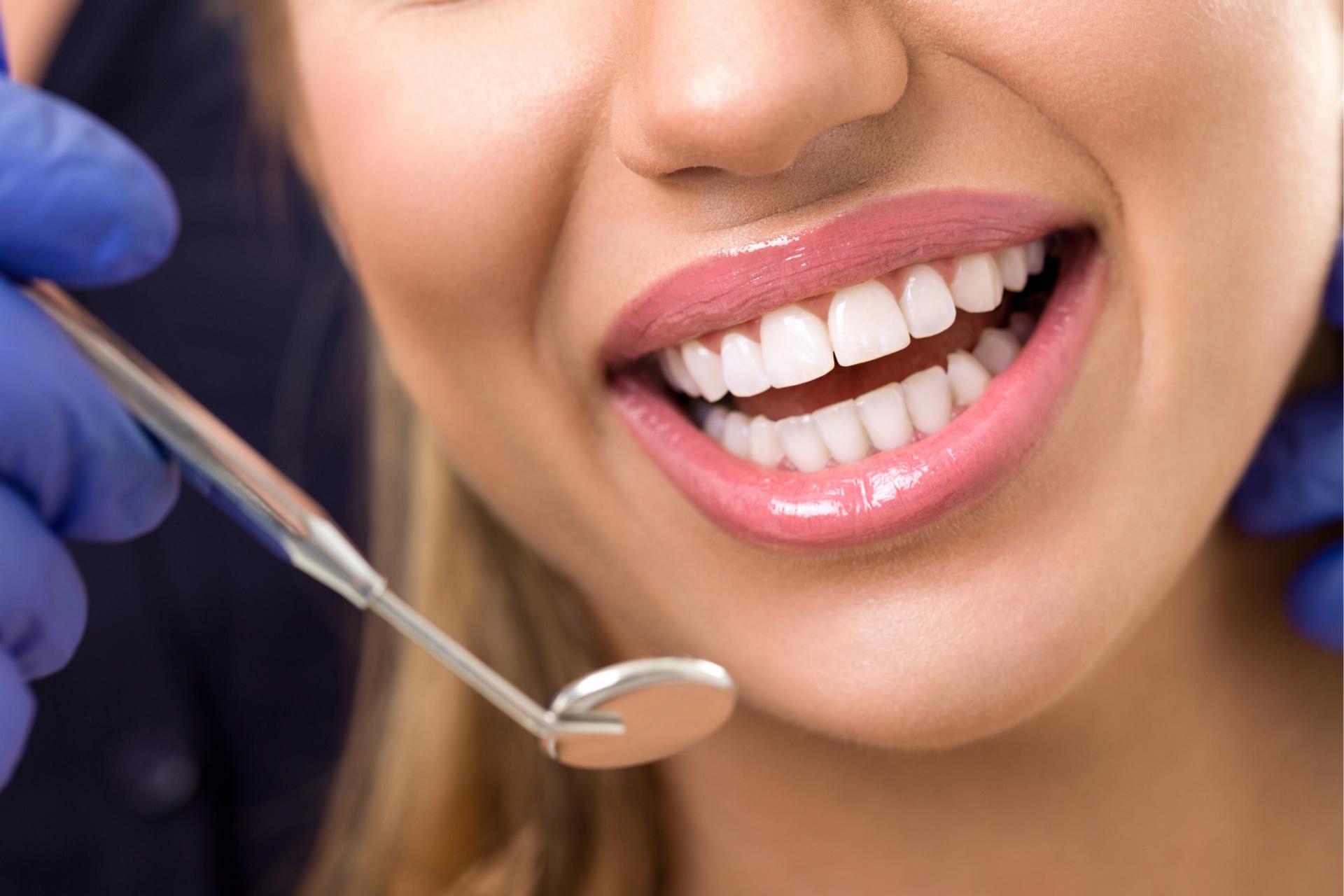 Comprehensive Dental Check Up Mount Druitt - Book Online Now!